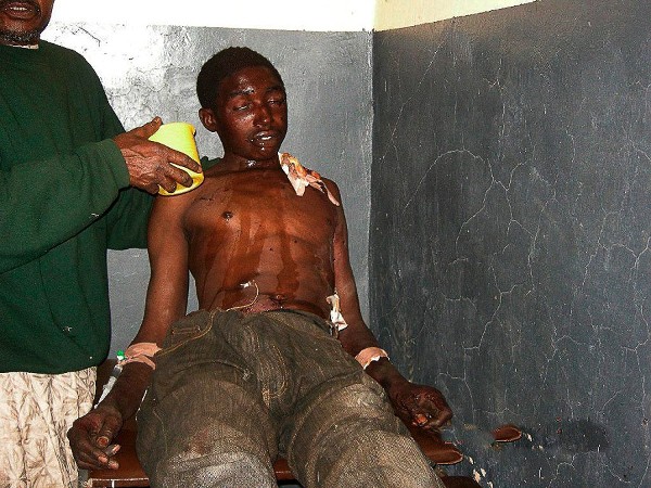 Un hombre limpia las heridas a un joven nigeriano en el hospital Murna tras los enfrentamientos entre jóvenes critianos y musulmanes en Nasarawa.