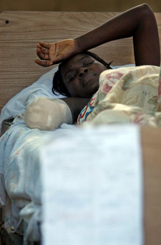 Una víctimas del terremoto descansa con el brazo amputado a las puertas de un hospital en Puerto Príncipe.