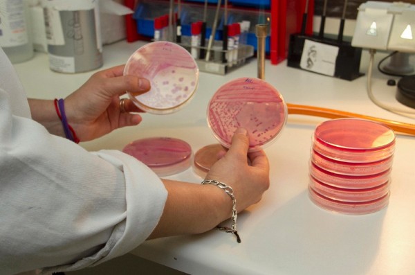 En la imagen, cultivo de la bacteria realizado en un laboratorio.