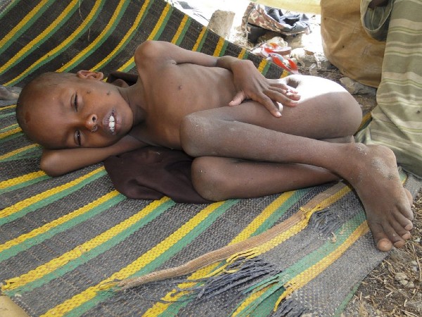 Una fotografía de archivo fechada el 10 de julio de 2011 que muestra a un niño que huyó con su familia de los devastadores efectos de la sequía en el sur de Somalia.