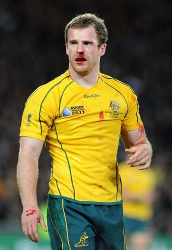 El jugador de Australia Pat McCabe sangra por la nariz.