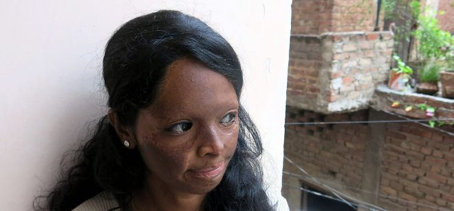 La joven india Laxmi fue atacada con ácido por un pretendiente frustrado.