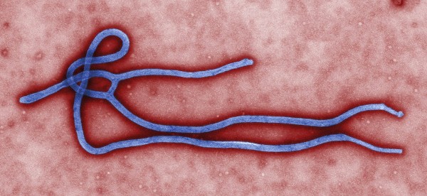 Imagen facilitada el 5 de agosto de 2014 por el Centro para el Control y Prevención de Enfermedades (CDC) estadounidense que muestra el virus del Ébola. 
