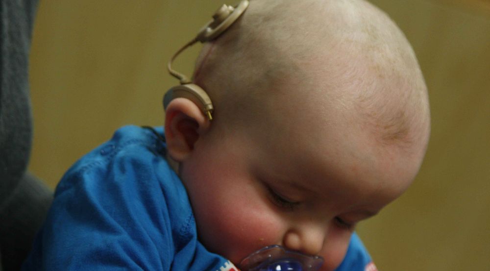 "Infant with cochlear implant" by Bjorn Knetsch from The Netherlands