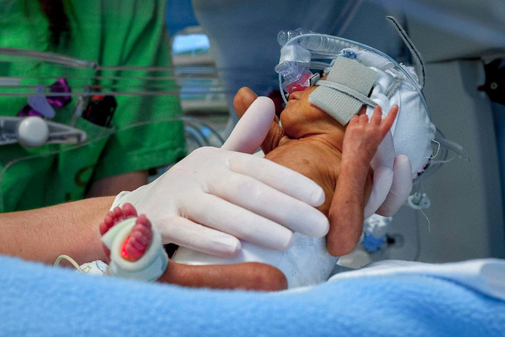 Una enfermera atiende a un bebé prematuro.