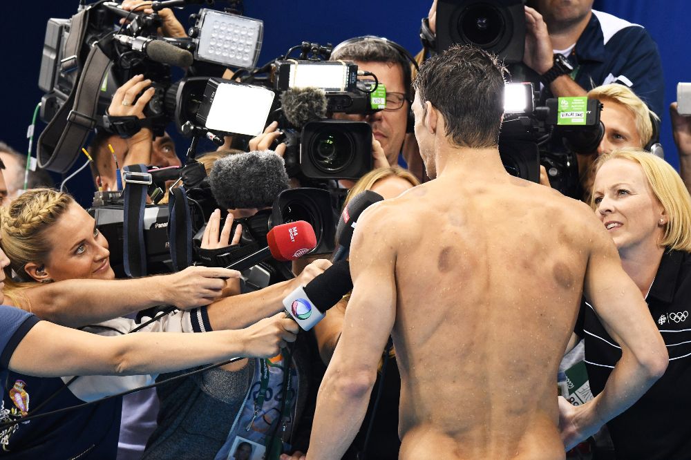 Michael Phelps muestra edn la espalda dos claros hematomas producto del tratamiento de 'cupping'.