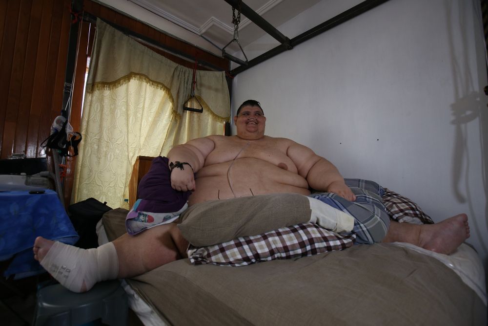 El mexicano Juan Pedro, quien con 595 kilos llegó a ser el hombre más obeso del mundo.