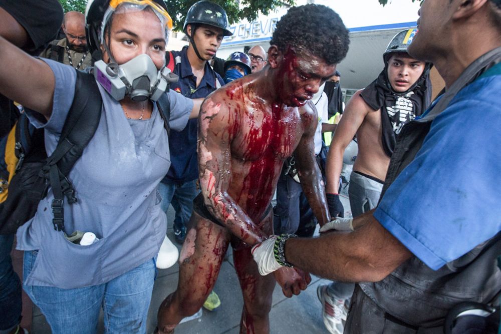 El joven Orlando José Figueroa tras ser alcanzado por las llamas durante una manifestación opositora el pasado sábado.