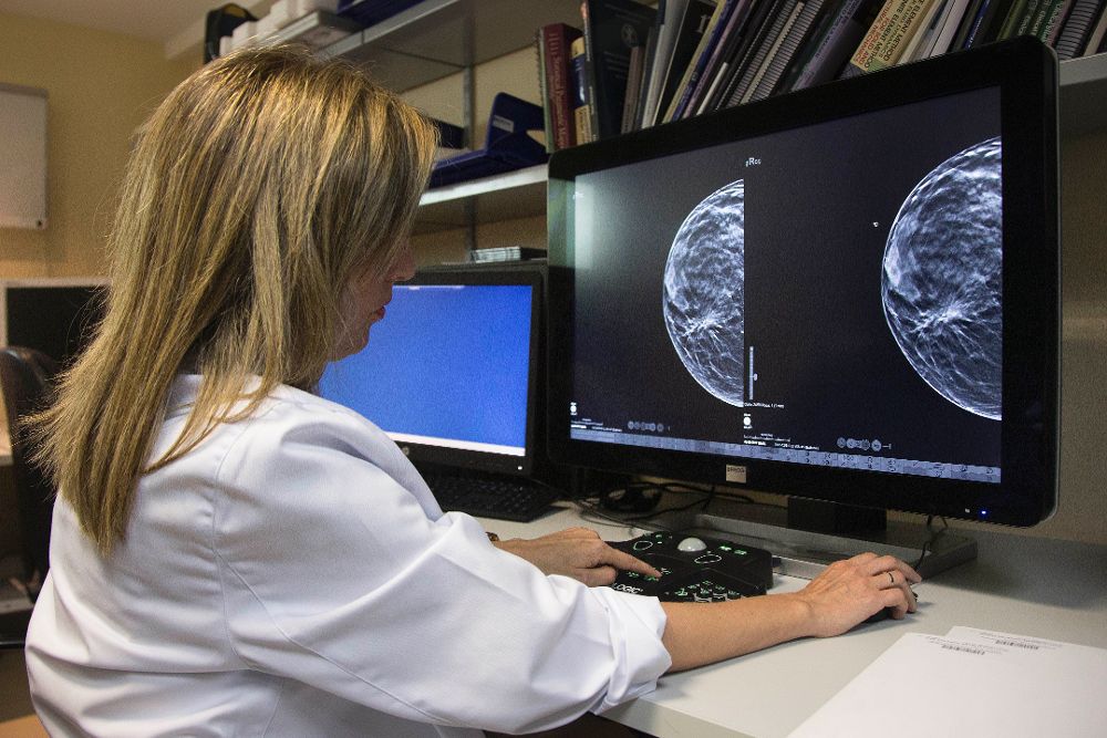 La Dra. Elena Cascón muestra una mamografía con fotosíntesis, durante la rueda de prensa en la que, el Hospital Quirónsalud, ha anunciado que pone en marcha una unidad para el tratamiento integral del cáncer de mama .