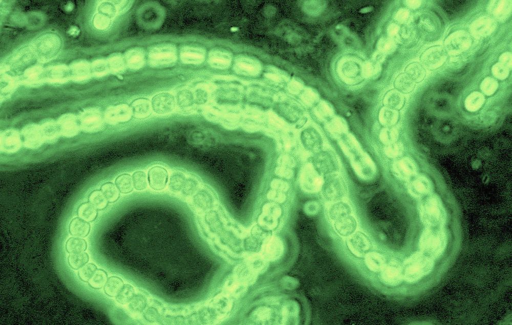 Las cianobacterias fueron unas de las primeras formas de vida en la Tierra, y aún pueden encontrarse en casi cualquier hábitat. A lo largo de millones de años, crearon el oxígeno atmosférico que respiramos hoy. (Imagen: Josef Reischig