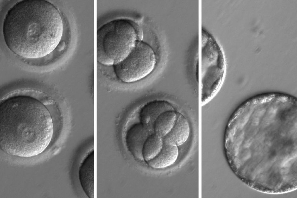 Secuencia del desarrollo de embriones después de la coinyección de una enzima correctora de genes y esperma de un donante con una mutación genética conocida por causar cardiomiopatía hipertrófica. 