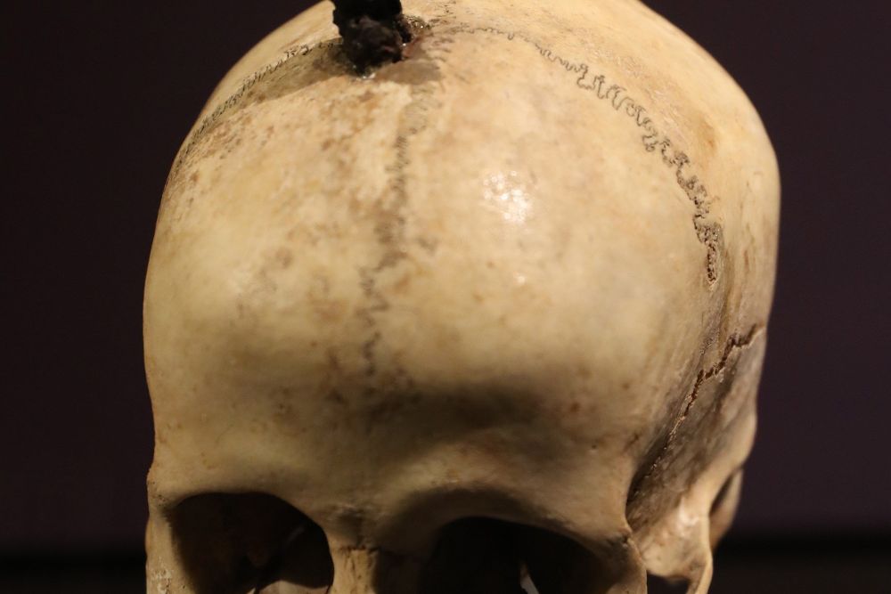 Cráneo ibérico enclavado, expuesto en el Museu D'Arqueología de Catalunya, que forma parte de la exposición.