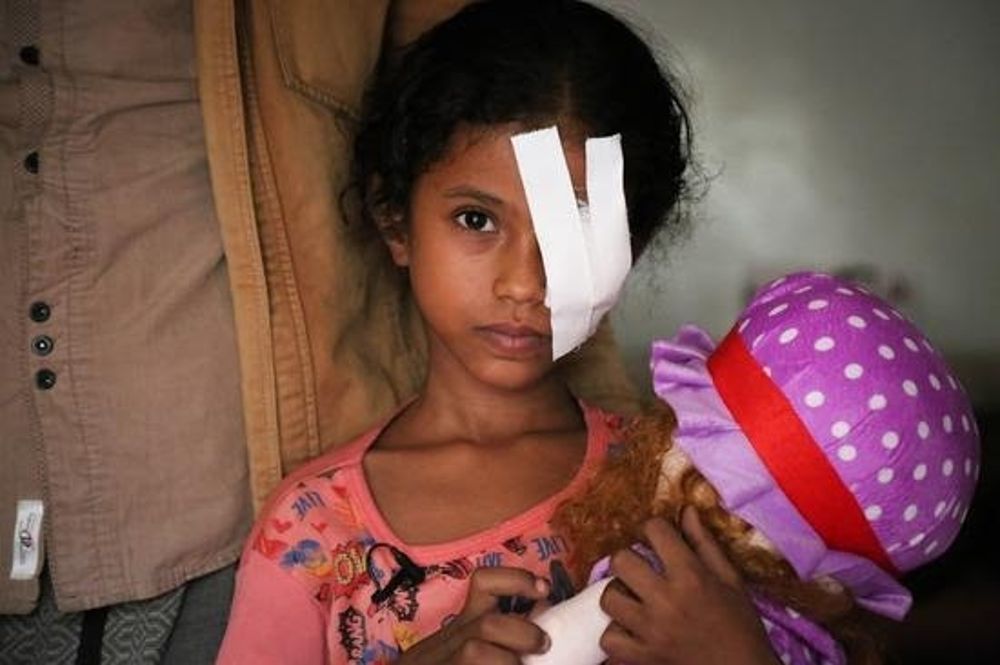 Una niña yemení afectada por los combates en Hodeida.