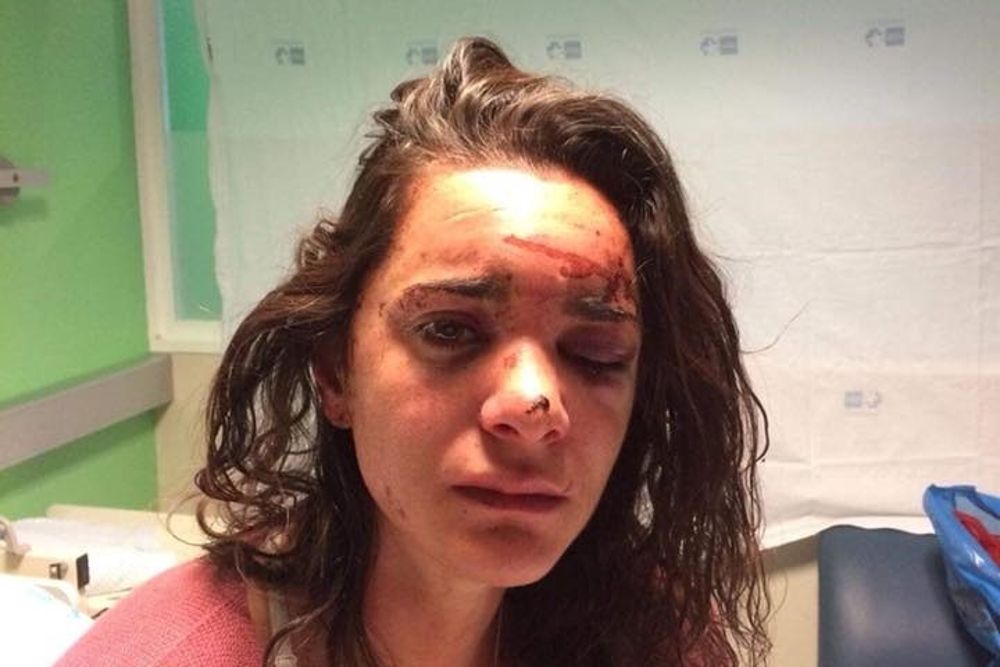 La joven estadounidense atacada y violada por un hombre este mes de diciembre cerca de la estación de autobuses de Aluche.