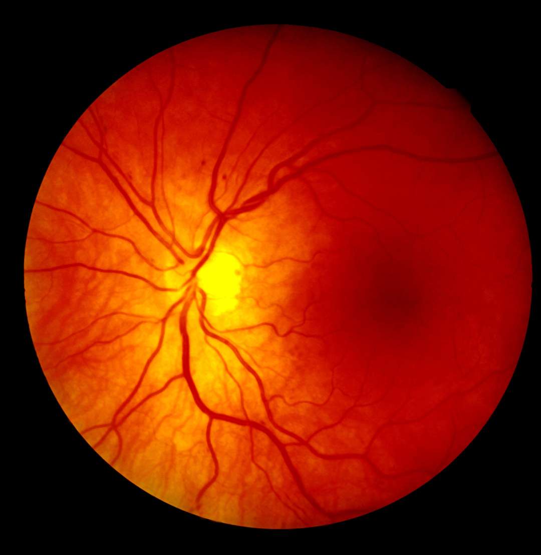 Los servicios de oftalmología deben avanzar en una atención de calidad centrada en el paciente.